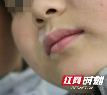 双胞胎儿子先后患白癜风 妻子患病丈夫一筹莫展