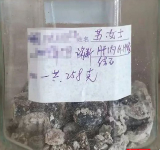 “石头记” 医院里的石头世界