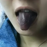 吃了假“五娭毑”臭豆腐真把嘴给染黑了，刷都刷不干净！