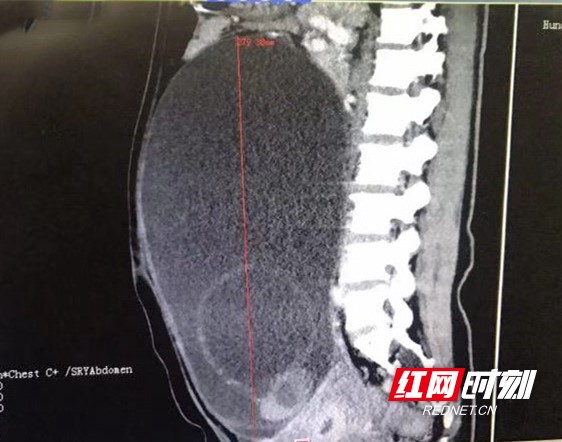 ????_20190301165607.wm.jpg ????_20190301165607.wm.jpg