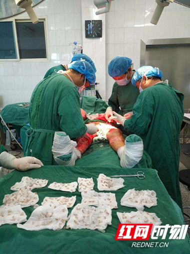 患者正在接受植皮手术，图中1平方厘米左右大小的块状物为患者头皮和手臂上切割的皮肤.jpg