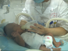 靖州：成功救治1.1kg极低体重多病早产儿