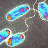 空调房中的“危险分子”：嗜肺军团菌是如何制造“空调肺”的