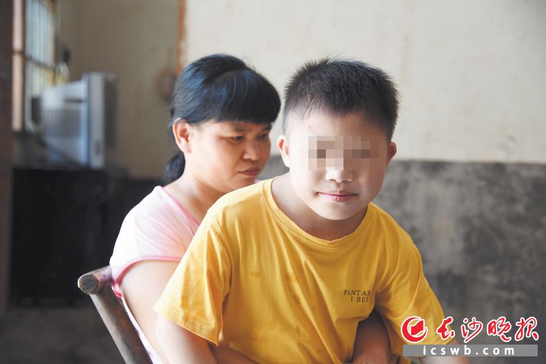 10岁的陈家旺患有多项先天性疾病,目前需要手术治疗。 长沙晚报全媒体记者 刘琦 摄