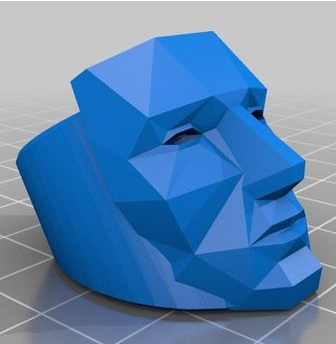 郴州市第一人民医院：3D打印新眼眶成功“补脸”
