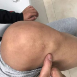 戏精！男子凭腿上“小鼓包”月入过万，结果…