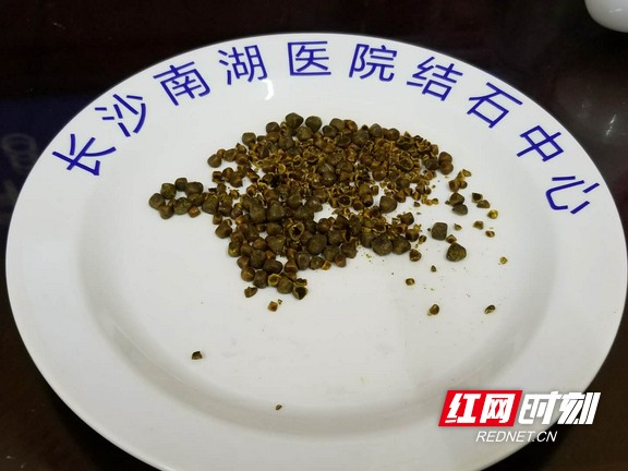 a72cfbeaf797879d9aaf3b227757d3f.wm.jpg a72cfbeaf797879d9aaf3b227757d3f.wm.jpg