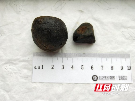 ????_20191206162144.wm.jpg ????_20191206162144.wm.jpg