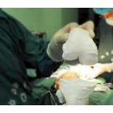 中国3D打印多孔钽假体已率先临床应用：3天私人定制膝关节