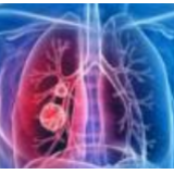 新型冠状病毒!武汉不明原因肺炎"元凶"初步判定!你最关心的5个问题有答案了…