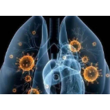 关于新型冠状病毒感染的肺炎，你必须知道这些！