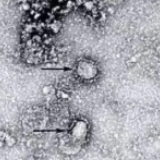 四川新增15例确诊病例，累计451例