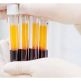 时刻知道丨被刷屏的治疗性新冠特免血浆是个啥？疫苗啥时候会有？
