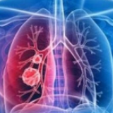 四川新增新冠肺炎确诊病例5例 累计确诊525例