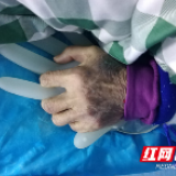 永州·驰援湖北丨张瑛的抗疫日记⑤：手套“热水袋” 暖手更暖心