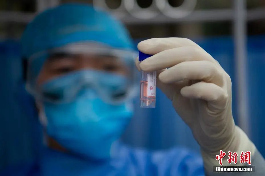 资料图:医疗人员查看咽拭子采样标本.中新社记者 韦亮 摄