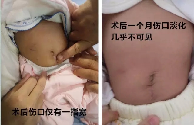 术前术后对比图.jpg