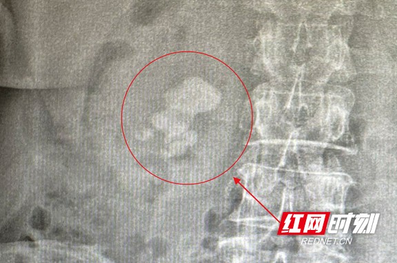 1591602699_看图王.wm.jpg