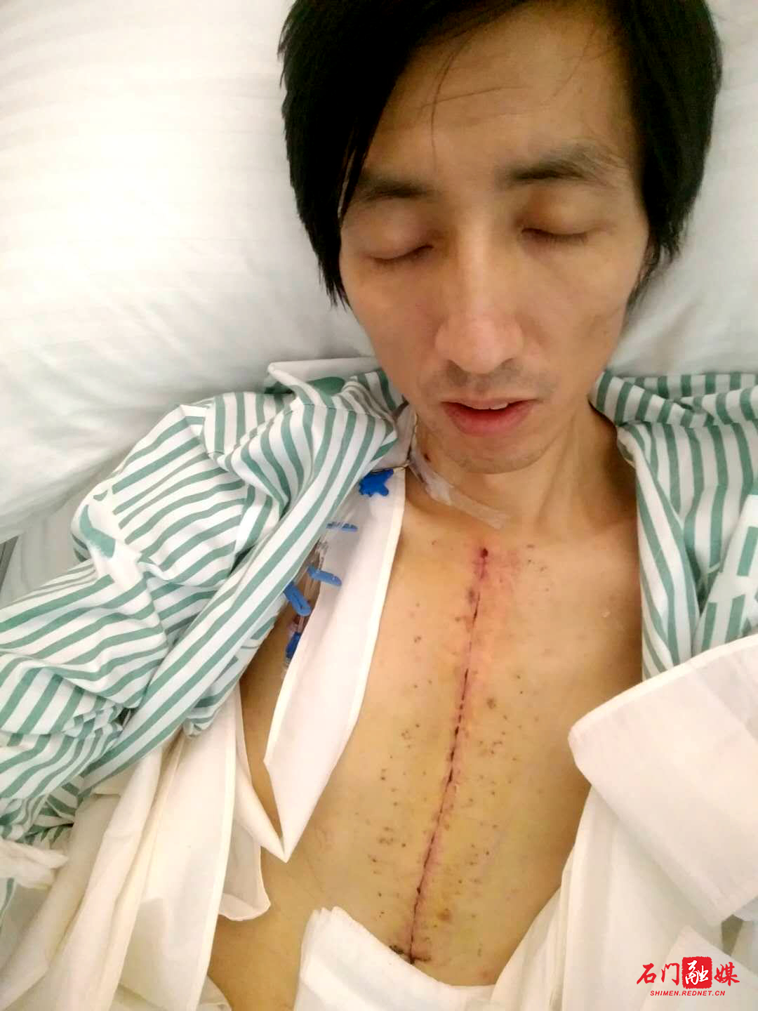 一次又一次的开胸手术,妈妈非常害怕,非常担心,心头的那根弦也绷得