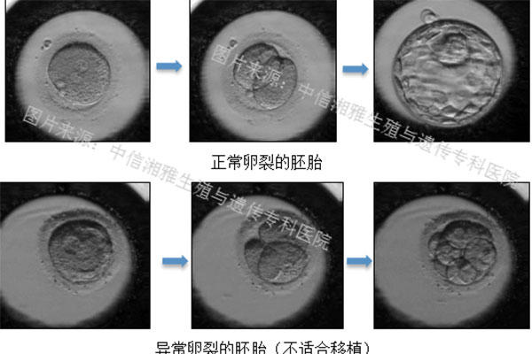 异形胚胎图片