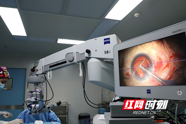 衡阳首台！爱尔眼科开展导航手术显微镜下散光人工晶体植入手术