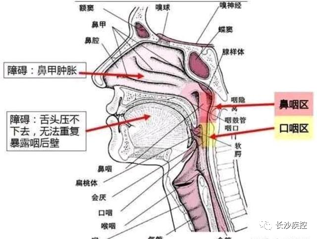 如果患有如鼻炎等鼻部疾病,可以採集口咽拭子嗎?