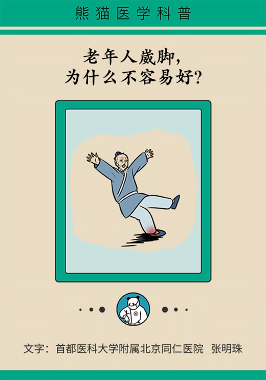 動不動崴腳與這疾病相關！解決方法遵循POLICE原則