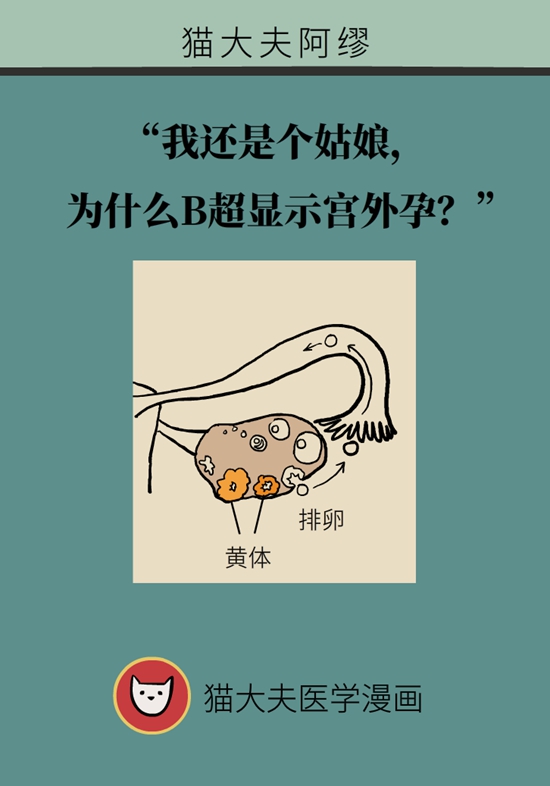 這種腹痛常被誤認(rèn)宮外孕，背后誘因要牢記