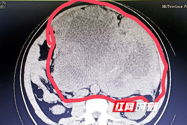 微信图片_20220616101758.jpg 微信图片_20220616101758.jpg