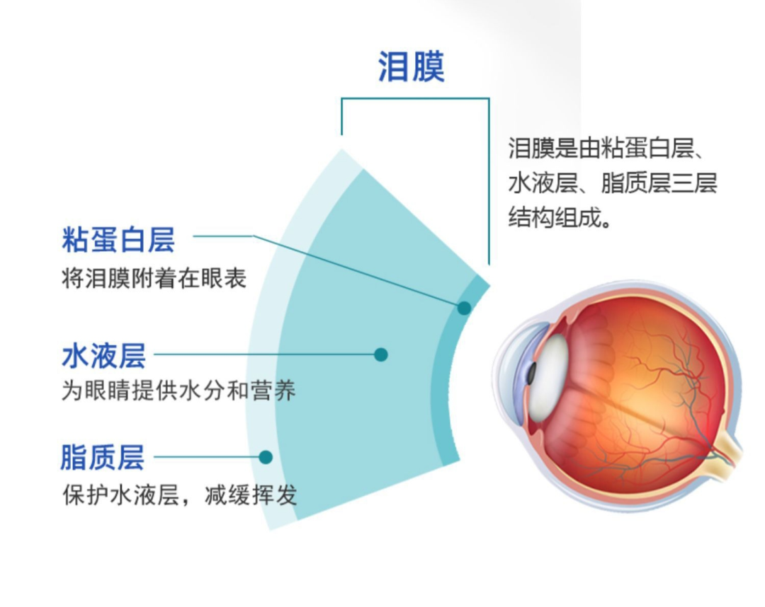 精彩回顾|李锦阳教授：泪膜破裂时间和类型引导的干眼诊断