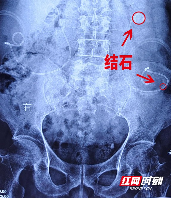 图片1.wm.jpg