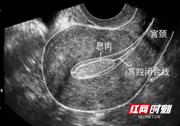 微信图片_20221125150840.png