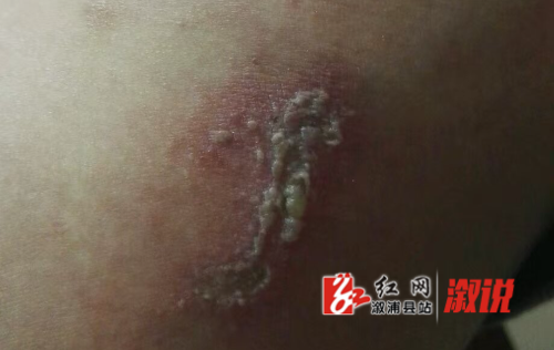 医生提供的就诊图 (6).jpg