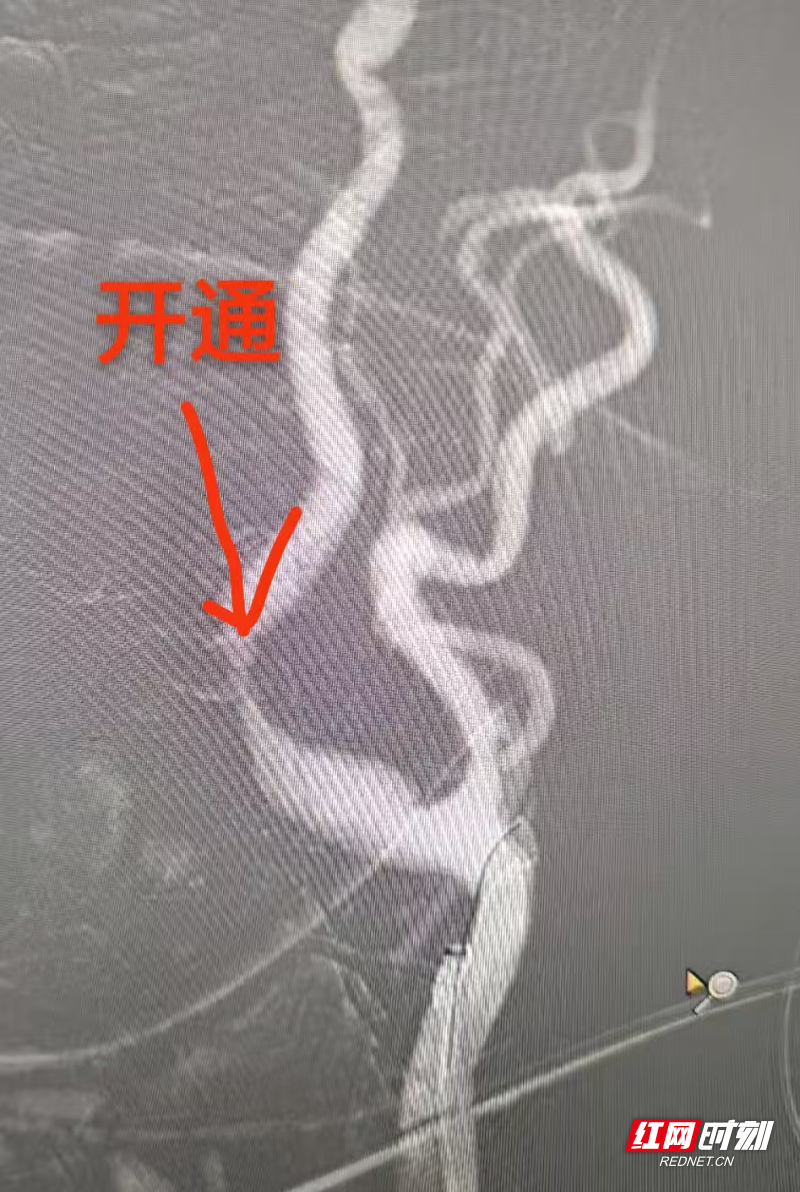 微信图片_20251106154240_774_215.jpg 微信图片_20251106154240_774_215.jpg