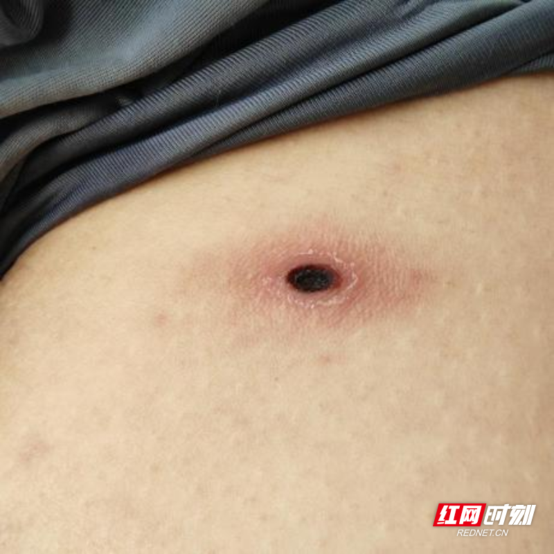 图片3.png 图片3.png