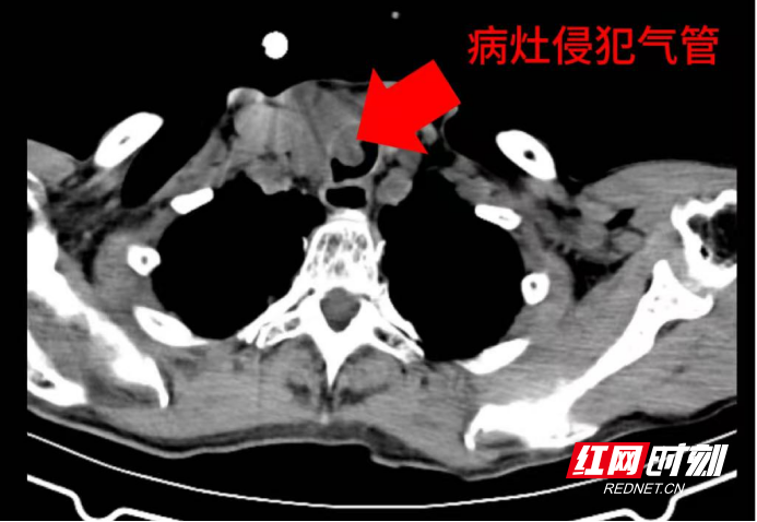 c4842e11-34fc-440e-b355-9cc72171ef1d.png c4842e11-34fc-440e-b355-9cc72171ef1d.png