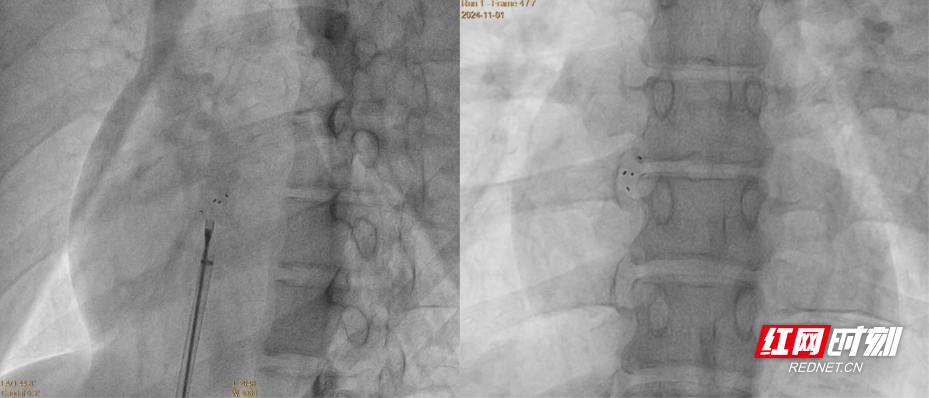 微信图片_20251128104841_1174_346.jpg 微信图片_20251128104841_1174_346.jpg
