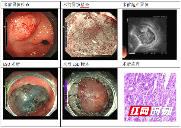 微信图片_20251209122623_397_64.png 微信图片_20251209122623_397_64.png