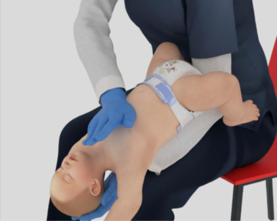 噎住窒息怎么办?别光“顶肚子” 新急救步骤速学