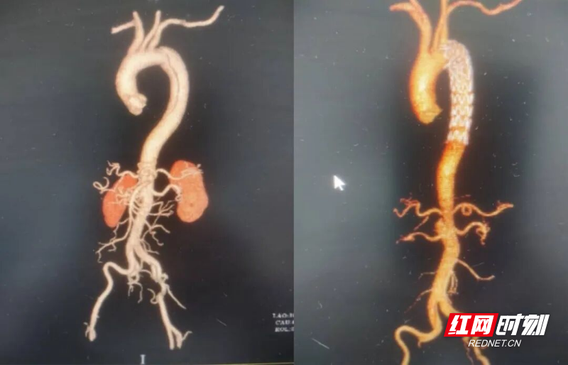 微信图片_20260326104548_2436_346.jpg 微信图片_20260326104548_2436_346.jpg