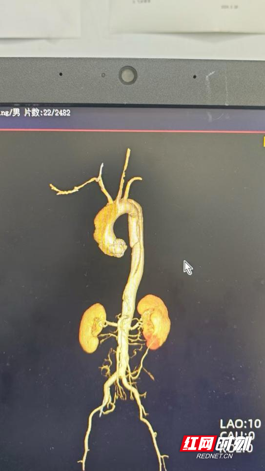图片18.png 图片18.png